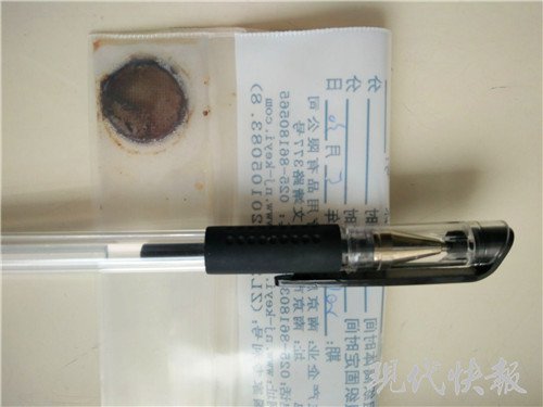 纽扣电池吞下肚 1岁女婴食道被腐蚀-中国搜索