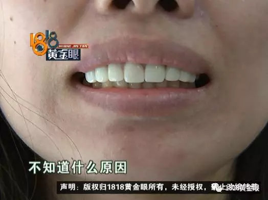 60多万,在杭州芭黎雅医疗美容诊所做一套牙科